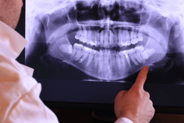 Professional Emergency Dentist in RI