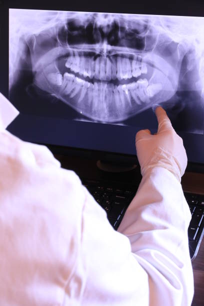 Best Emergency Tooth Extraction in Pawtucket, RI