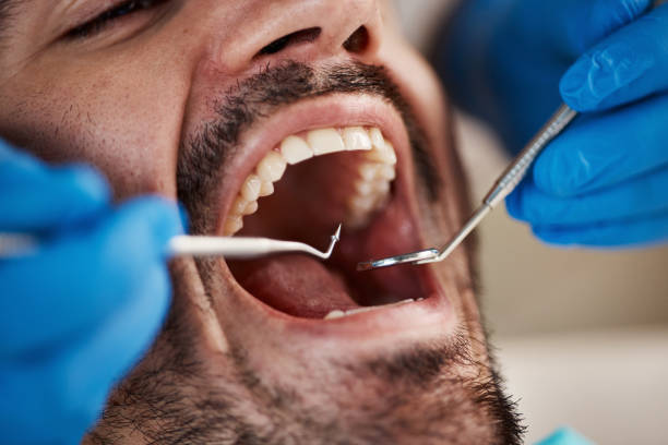 Best Emergency Dental Care for Broken or Chipped Teeth in Pawtucket, RI